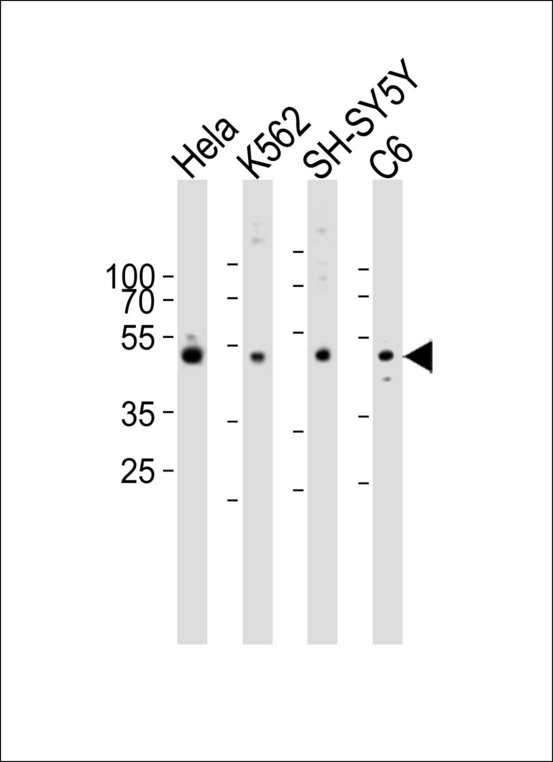 PAFAH1B1 / LIS1 Antibody - Western blot of lysates from HeLa, K562, SH-SY5Y, rat C6 cell line (from left to right) with PAFAH1B1 Antibody. Antibody was diluted at 1:1000 at each lane. A goat anti-rabbit IgG H&L (HRP) at 1:10000 dilution was used as the secondary antibody. Lysates at 20 ug per lane.