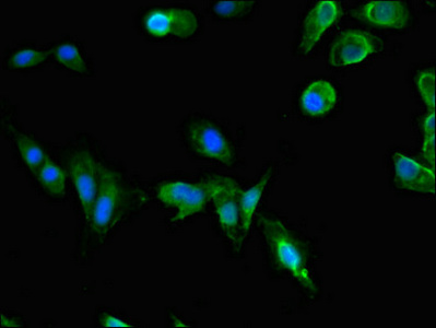 PAFAH1B1 / LIS1 Antibody - Immunofluorescent analysis of Hela cells using PAFAH1B1 Antibody at dilution of 1:100 and Alexa Fluor 488-congugated AffiniPure Goat Anti-Rabbit IgG(H+L)
