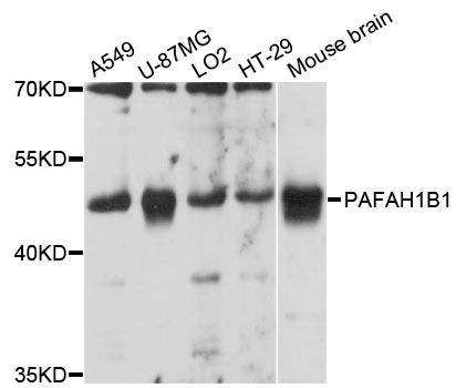 PAFAH1B1 / LIS1 Antibody - Western blot analysis of extracts of various cell lines, using PAFAH1B1 antibody at 1:3000 dilution. The secondary antibody used was an HRP Goat Anti-Rabbit IgG (H+L) at 1:10000 dilution. Lysates were loaded 25ug per lane and 3% nonfat dry milk in TBST was used for blocking. An ECL Kit was used for detection and the exposure time was 10s.