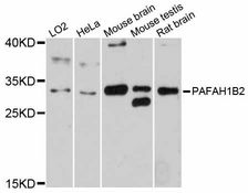 PAFAH1B2 Antibody - Western blot analysis of extracts of various cell lines, using PAFAH1B2 antibody at 1:3000 dilution. The secondary antibody used was an HRP Goat Anti-Rabbit IgG (H+L) at 1:10000 dilution. Lysates were loaded 25ug per lane and 3% nonfat dry milk in TBST was used for blocking. An ECL Kit was used for detection and the exposure time was 30s.