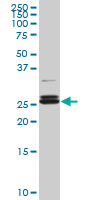 PAFAH1B3 Antibody - PAFAH1B3 monoclonal antibody (M08), clone 3G6. Western blot of PAFAH1B3 expression in IMR-32.