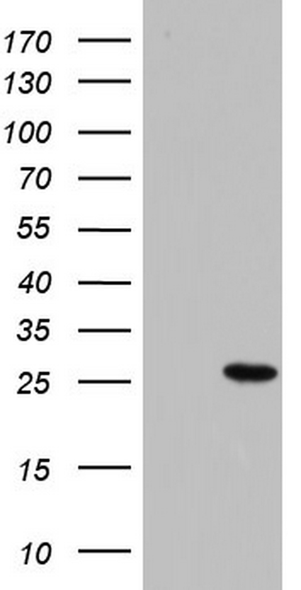 PAFAH1B3 Antibody - HEK293T cells were transfected with the pCMV6-ENTRY control. (Left lane) or pCMV6-ENTRY PAFAH1B3. (Right lane) cDNA for 48 hrs and lysed. Equivalent amounts of cell lysates. (5 ug per lane) were separated by SDS-PAGE and immunoblotted with anti-PAFAH1B3.
