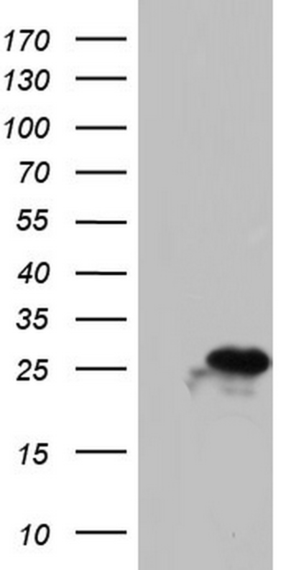 PAFAH1B3 Antibody - HEK293T cells were transfected with the pCMV6-ENTRY control. (Left lane) or pCMV6-ENTRY PAFAH1B3. (Right lane) cDNA for 48 hrs and lysed. Equivalent amounts of cell lysates. (5 ug per lane) were separated by SDS-PAGE and immunoblotted with anti-PAFAH1B3.