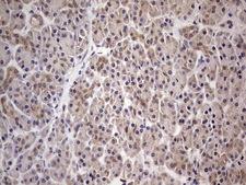 PAFAH1B3 Antibody - Immunohistochemical staining of paraffin-embedded Human pancreas tissue within the normal limits using anti-PAFAH1B3 mouse monoclonal antibody. (Heat-induced epitope retrieval by 1 mM EDTA in 10mM Tris, pH8.5, 120C for 3min,