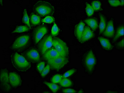 PAFAH1B3 Antibody - Immunofluorescence staining of A549 cells at a dilution of 1:200, counter-stained with DAPI. The cells were fixed in 4% formaldehyde, permeabilized using 0.2% Triton X-100 and blocked in 10% normal Goat Serum. The cells were then incubated with the antibody overnight at 4 °C.The secondary antibody was Alexa Fluor 488-congugated AffiniPure Goat Anti-Rabbit IgG (H+L) .