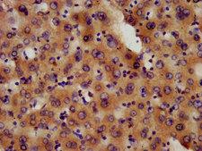 PAFAH1B3 Antibody - Immunohistochemistry image at a dilution of 1:600 and staining in paraffin-embedded human liver tissue performed on a Leica BondTM system. After dewaxing and hydration, antigen retrieval was mediated by high pressure in a citrate buffer (pH 6.0) . Section was blocked with 10% normal goat serum 30min at RT. Then primary antibody (1% BSA) was incubated at 4 °C overnight. The primary is detected by a biotinylated secondary antibody and visualized using an HRP conjugated SP system.
