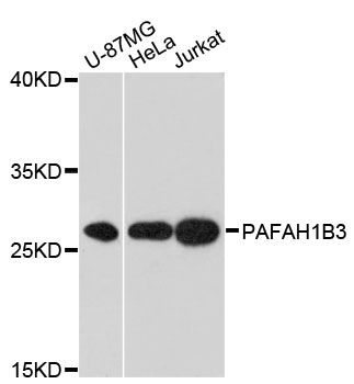 PAFAH1B3 Antibody - Western blot analysis of extracts of various cell lines, using PAFAH1B3 antibody at 1:3000 dilution. The secondary antibody used was an HRP Goat Anti-Rabbit IgG (H+L) at 1:10000 dilution. Lysates were loaded 25ug per lane and 3% nonfat dry milk in TBST was used for blocking. An ECL Kit was used for detection and the exposure time was 30s.