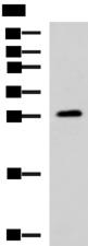 PAFAH1B3 Antibody - Western blot analysis of Human fetal brain tissue lysate  using PAFAH1B3 Polyclonal Antibody at dilution of 1:1000
