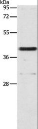 PAFAH2 Antibody - Western blot analysis of 231 cell, using PAFAH2 Polyclonal Antibody at dilution of 1:700.