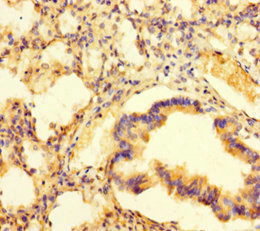 PAG1 Antibody - Immunohistochemistry of paraffin-embedded human lung tissue at dilution of 1:100