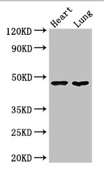 PAG1 Antibody - Western Blot Positive WB detected in:Mouse heart tissue,Mouse lung tissue All Lanes: PAG1 antibody at 3ug/ml Secondary Goat polyclonal to rabbit IgG at 1/50000 dilution Predicted band size: 47 kDa Observed band size: 47 kDa
