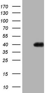 PAGE1 Antibody - HEK293T cells were transfected with the pCMV6-ENTRY control. (Left lane) or pCMV6-ENTRY PAGE1. (Right lane) cDNA for 48 hrs and lysed. Equivalent amounts of cell lysates. (5 ug per lane) were separated by SDS-PAGE and immunoblotted with anti-PAGE1.