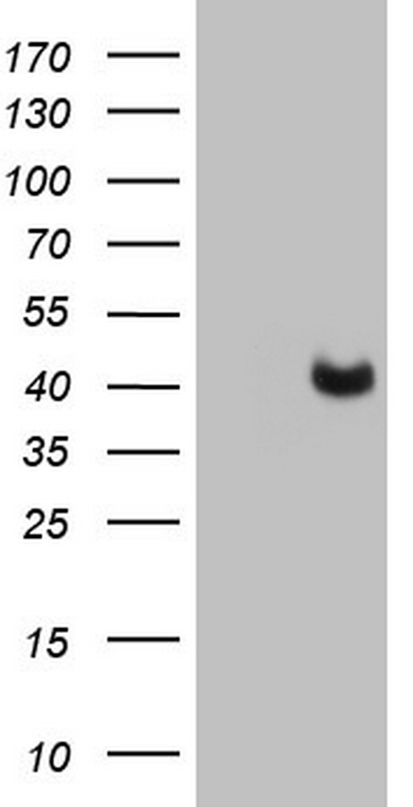 PAGE1 Antibody - HEK293T cells were transfected with the pCMV6-ENTRY control (Left lane) or pCMV6-ENTRY PAGE1 (Right lane) cDNA for 48 hrs and lysed. Equivalent amounts of cell lysates (5 ug per lane) were separated by SDS-PAGE and immunoblotted with anti-PAGE1.