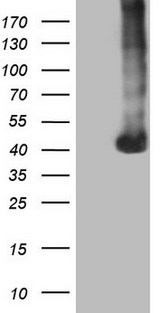 PAGE1 Antibody - HEK293T cells were transfected with the pCMV6-ENTRY control. (Left lane) or pCMV6-ENTRY PAGE1. (Right lane) cDNA for 48 hrs and lysed. Equivalent amounts of cell lysates. (5 ug per lane) were separated by SDS-PAGE and immunoblotted with anti-PAGE1.