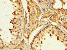 PAGE1 Antibody - Immunohistochemistry of paraffin-embedded human testis tissue using PAGE1 Antibody at dilution of 1:100