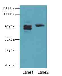 PAH Antibody - Western blot. All lanes: PAH antibody at 2.5 ug/ml. Lane 1: Mouse kidney tissue. Lane 2: Mouse liver tissue. Secondary Goat polyclonal to Rabbit IgG at 1:10000 dilution. Predicted band size: 52 kDa. Observed band size: 52 kDa.