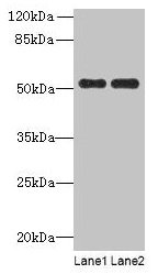 PAH Antibody - Western blot All lanes: PAH antibody at 2.5µg/ml Lane 1: Mouse kidney tissue Lane 2: Mouse liver tissue Secondary Goat polyclonal to rabbit IgG at 1/10000 dilution Predicted band size: 52 kDa Observed band size: 52 kDa