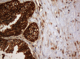 PAI-RBP1 / SERBP1 Antibody - IHC of paraffin-embedded Human prostate tissue using anti-SERBP1 mouse monoclonal antibody. (Heat-induced epitope retrieval by 10mM citric buffer, pH6.0, 120°C for 3min).