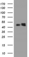 PAI-RBP1 / SERBP1 Antibody - HEK293T cells were transfected with the pCMV6-ENTRY control (Left lane) or pCMV6-ENTRY SERBP1 (Right lane) cDNA for 48 hrs and lysed. Equivalent amounts of cell lysates (5 ug per lane) were separated by SDS-PAGE and immunoblotted with anti-SERBP1.
