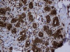 PAI-RBP1 / SERBP1 Antibody - IHC of paraffin-embedded Human breast tissue using anti-SERBP1 mouse monoclonal antibody.