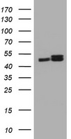 PAI-RBP1 / SERBP1 Antibody - HEK293T cells were transfected with the pCMV6-ENTRY control (Left lane) or pCMV6-ENTRY SERBP1 (Right lane) cDNA for 48 hrs and lysed. Equivalent amounts of cell lysates (5 ug per lane) were separated by SDS-PAGE and immunoblotted with anti-SERBP1.