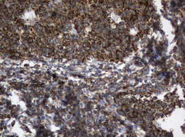 PAI-RBP1 / SERBP1 Antibody - IHC of paraffin-embedded Human lymph node tissue using anti-SERBP1 mouse monoclonal antibody.
