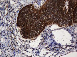 PAI-RBP1 / SERBP1 Antibody - IHC of paraffin-embedded Human endometrium tissue using anti-SERBP1 mouse monoclonal antibody.