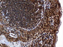 PAI-RBP1 / SERBP1 Antibody - IHC of paraffin-embedded Human tonsil using anti-SERBP1 mouse monoclonal antibody.