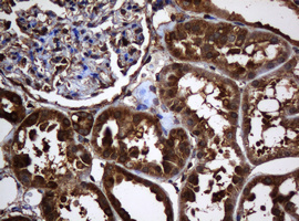 PAI-RBP1 / SERBP1 Antibody - IHC of paraffin-embedded Human Kidney tissue using anti-SERBP1 mouse monoclonal antibody.