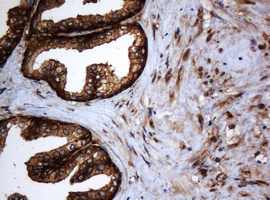 PAI-RBP1 / SERBP1 Antibody - IHC of paraffin-embedded Human prostate tissue using anti-SERBP1 mouse monoclonal antibody.