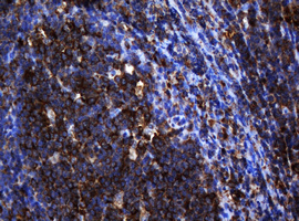 PAI-RBP1 / SERBP1 Antibody - IHC of paraffin-embedded Human lymph node tissue using anti-SERBP1 mouse monoclonal antibody.