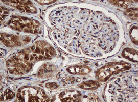 PAI-RBP1 / SERBP1 Antibody - IHC of paraffin-embedded Human Kidney tissue using anti-SERBP1 mouse monoclonal antibody.