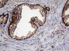 PAI-RBP1 / SERBP1 Antibody - IHC of paraffin-embedded Human prostate tissue using anti-SERBP1 mouse monoclonal antibody.