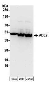 PAICS / ADE2 Antibody - Detection of human ADE2 by western blot. Samples: Whole cell lysate (50 µg) from HeLa, HEK293T, and Jurkat cells prepared using NETN lysis buffer. Antibodies: Affinity purified rabbit anti-ADE2 antibody used for WB at 0.1 µg/ml. Detection: Chemiluminescence with an exposure time of 30 seconds.