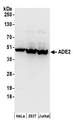 PAICS / ADE2 Antibody - Detection of human ADE2 by western blot. Samples: Whole cell lysate (50 µg) from HeLa, HEK293T, and Jurkat cells prepared using NETN lysis buffer. Antibodies: Affinity purified rabbit anti-ADE2 antibody used for WB at 0.1 µg/ml. Detection: Chemiluminescence with an exposure time of 30 seconds.