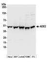 PAICS / ADE2 Antibody - Detection of human and mouse ADE2 by western blot. Samples: Whole cell lysate (50 µg) from HeLa, HEK293T, Jurkat, mouse TCMK-1, and mouse NIH 3T3 cells prepared using NETN lysis buffer. Antibodies: Affinity purified rabbit anti-ADE2 antibody used for WB at 0.1 µg/ml. Detection: Chemiluminescence with an exposure time of 30 seconds.