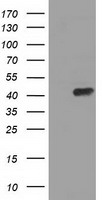 PAICS / ADE2 Antibody - HEK293T cells were transfected with the pCMV6-ENTRY control (Left lane) or pCMV6-ENTRY PAICS (Right lane) cDNA for 48 hrs and lysed. Equivalent amounts of cell lysates (5 ug per lane) were separated by SDS-PAGE and immunoblotted with anti-PAICS.