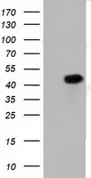 PAICS / ADE2 Antibody - HEK293T cells were transfected with the pCMV6-ENTRY control (Left lane) or pCMV6-ENTRY PAICS (Right lane) cDNA for 48 hrs and lysed. Equivalent amounts of cell lysates (5 ug per lane) were separated by SDS-PAGE and immunoblotted with anti-PAICS.