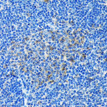 PAICS / ADE2 Antibody - Immunohistochemistry of paraffin-embedded rat spleen tissue.