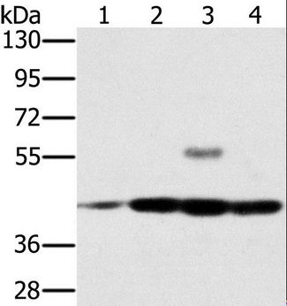 PAICS / ADE2 Antibody - Western blot analysis of Jurkat, Raji, K562 and HeLa cell, using PAICS Polyclonal Antibody at dilution of 1:400.