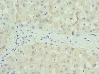 PAICS / ADE2 Antibody - Immunohistochemistry of paraffin-embedded human liver tissue at dilution 1:100