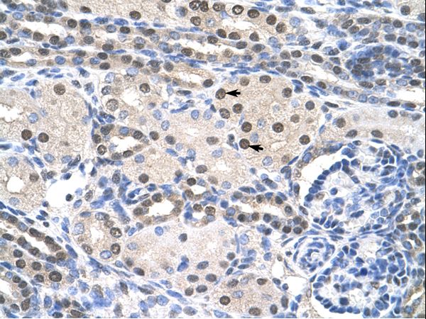 PAIP1 Antibody - PAIP1 antibody ARP40651_T100-NP_877590-PAIP1 (poly(A) binding protein interacting protein 1) Antibody was used in IHC to stain formalin-fixed, paraffin-embedded human kidney.  This image was taken for the unconjugated form of this product. Other forms have not been tested.