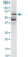 PAIP1 Antibody - PAIP1 monoclonal antibody (M04), clone 2D11. Western blot of PAIP1 expression in HeLa.