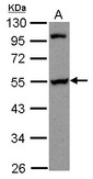 PAIP1 Antibody - Sample (30 ug of whole cell lysate) A: A431 10% SDS PAGE PAIP1 antibody diluted at 1:1000