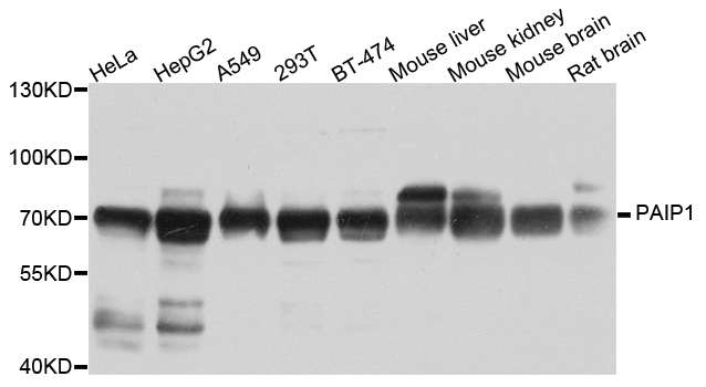 PAIP1 Antibody - Western blot analysis of extract of various cells.