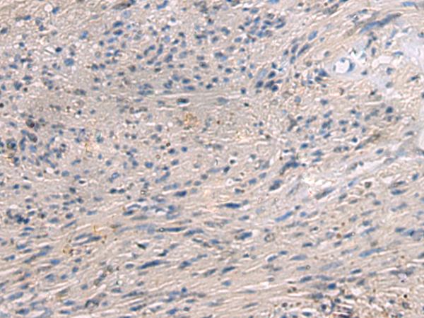 PAIP1 Antibody - Immunohistochemistry of paraffin-embedded Human brain tissue  using PAIP1 Polyclonal Antibody at dilution of 1:80(×200)