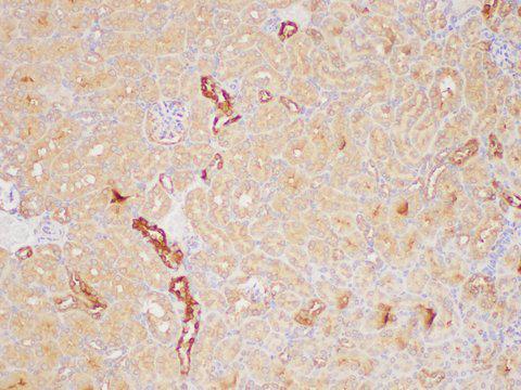 PAIP1 Antibody - Immunohistochemistry of paraffin-embedded Mouse kidney using PAIP1 Polycloanl Antibody at dilution of 1:200