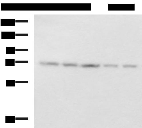PAIP1 Antibody - Western blot analysis of 293T PC3 cell Mouse liver tissue and Mouse kidney tissue lysates  using PAIP1 Polyclonal Antibody at dilution of 1:800