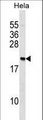 PAIP2 Antibody - PAIP2 Antibody western blot of HeLa cell line lysates (35 ug/lane). The PAIP2 antibody detected the PAIP2 protein (arrow).