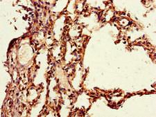 PAIP2 Antibody - Immunohistochemistry of paraffin-embedded human lung tissue using PAIP2 Antibody at dilution of 1:100